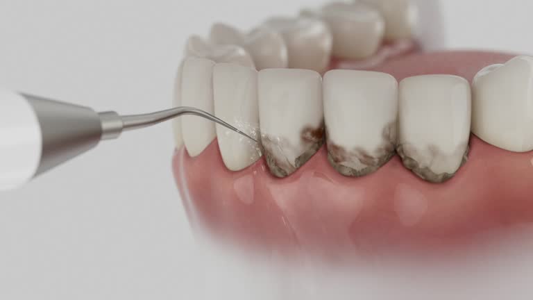 Trusted Dental Implants service in Leadington, MO - Dentist Open Now